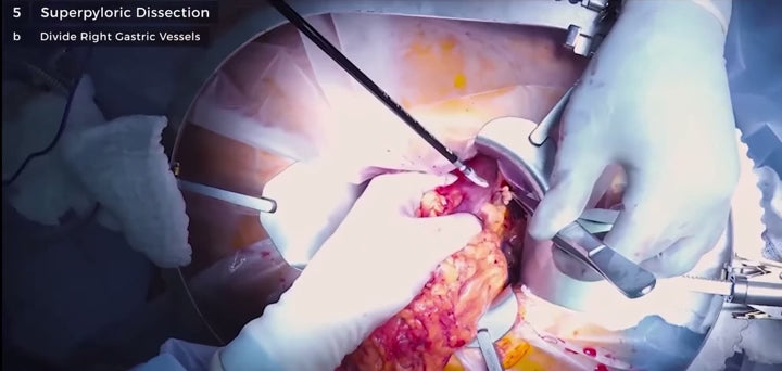 Surgical Mastery: From Basics to Advanced Techniques