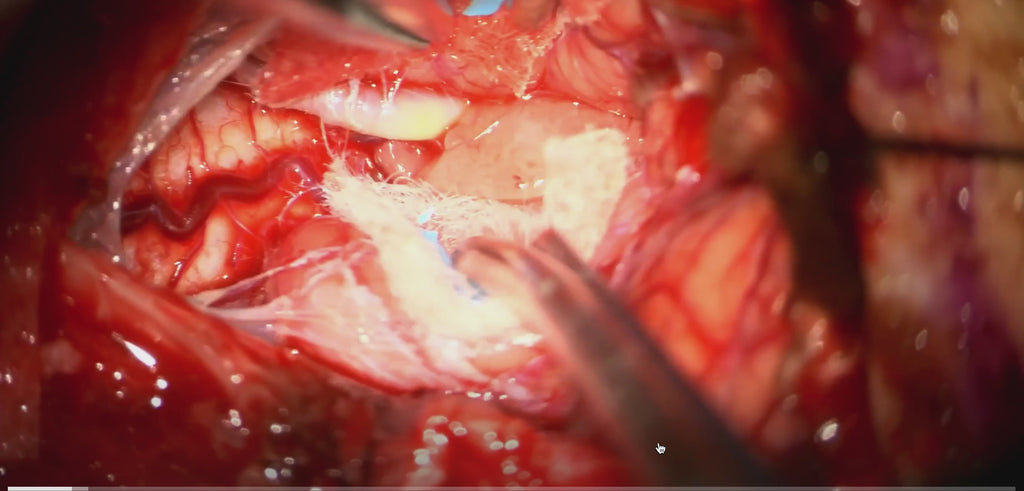 Surgical Mastery: From Basics to Advanced Techniques